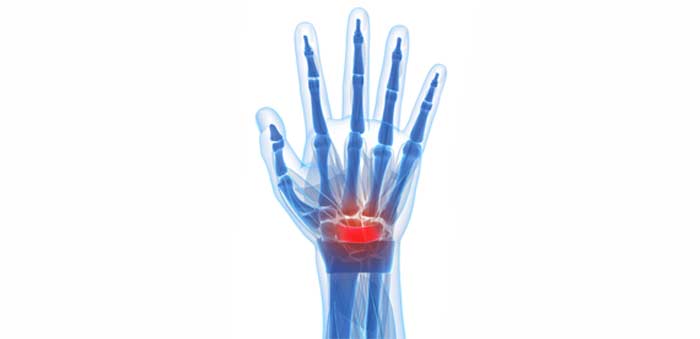 Carpal-Tunnel-Syndrome-L.A.-Orthopedic-&-Pain-Center
