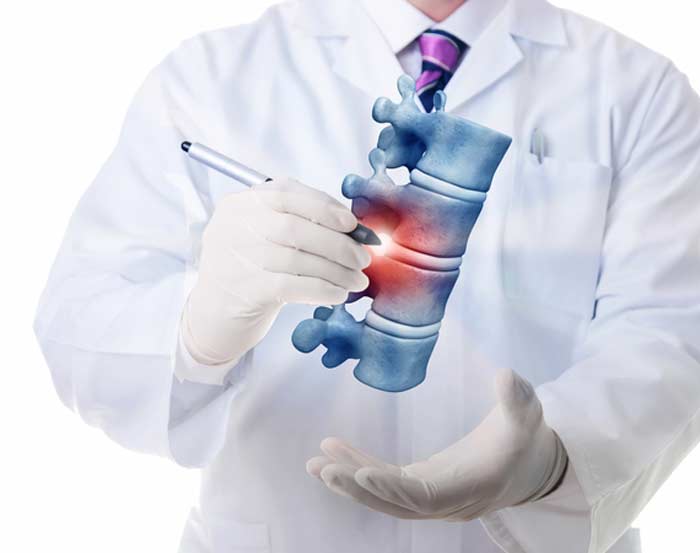 Epidural-Injections-L.A.-Orthopedic-&-Pain-Center