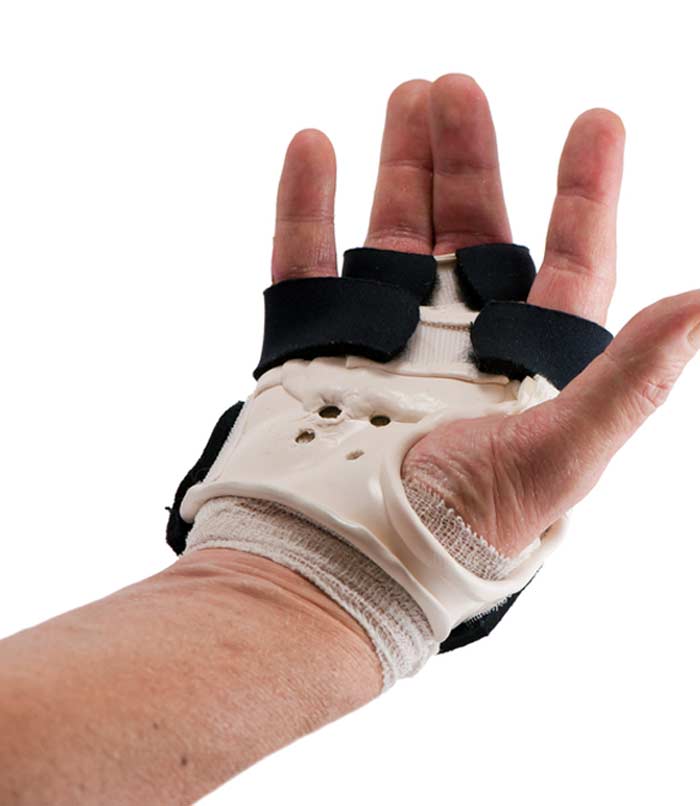 Hand-Surgery-L.A.-Orthopedic-&-Pain-Center
