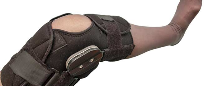 Ligament Tears - L.A. Orthopedic & Pain Center