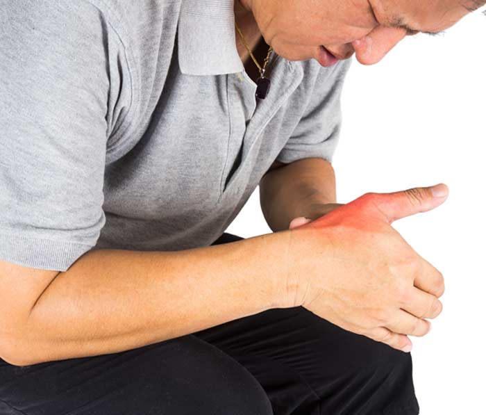 Man with Gout - L.A. Orthopedic & Pain Center