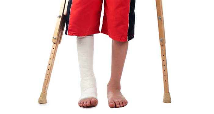 Patient with Fractures - L.A. Orthopedic & Pain Center