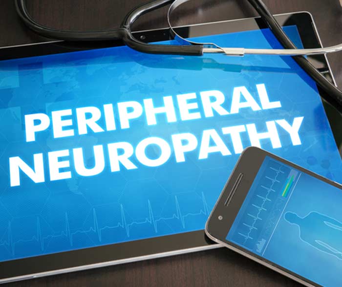 Peripheral-Neuropathy-L.A.-Orthopedic-&-Pain-Center
