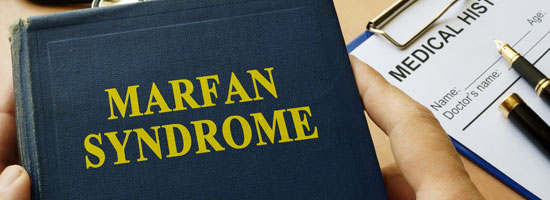 Understanding-Marfan-Syndrome-Los-Angeles-Ortho-&-Pain